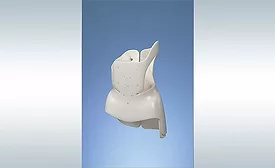 Standardization Helps Medical Device Manufacturer Produce Custom Orthotics