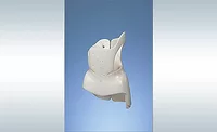 Standardization Helps Medical Device Manufacturer Produce Custom Orthotics
