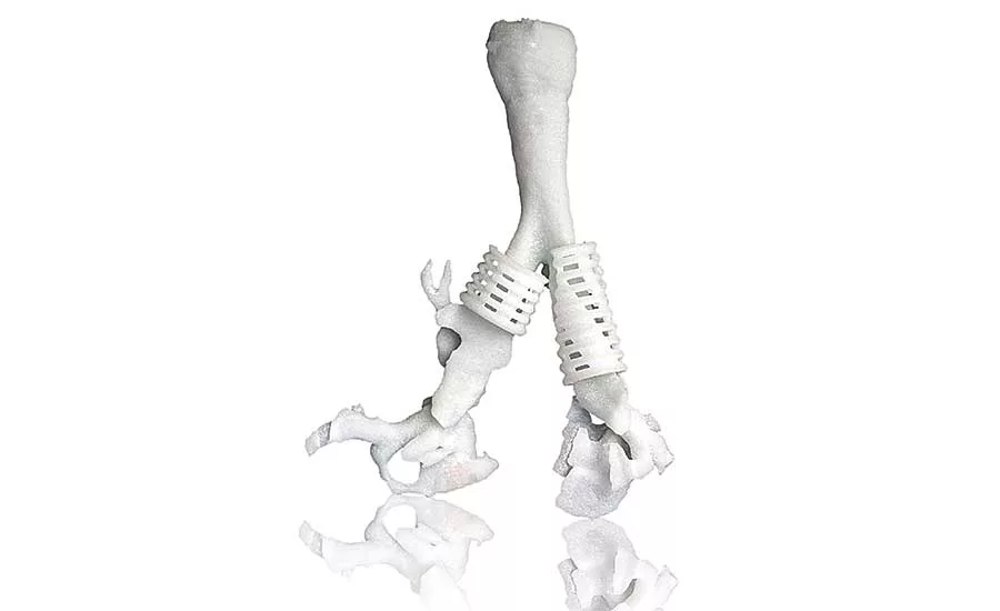 Additive Manufacturing for Medical Device Production