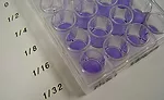 New Standard for Biocompatibility Testing