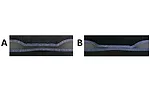 Spot Welding Metal-Plastic Composites