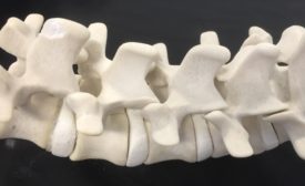 3D Spine News