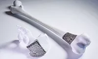 stryker-implant-900.jpg